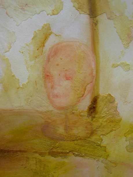 resistoutsidedetail2